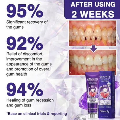 🦷【BOGO】Slimoly Bee Venom Toothpaste for Bleeding Gums & Periodontal Care👨‍⚕️